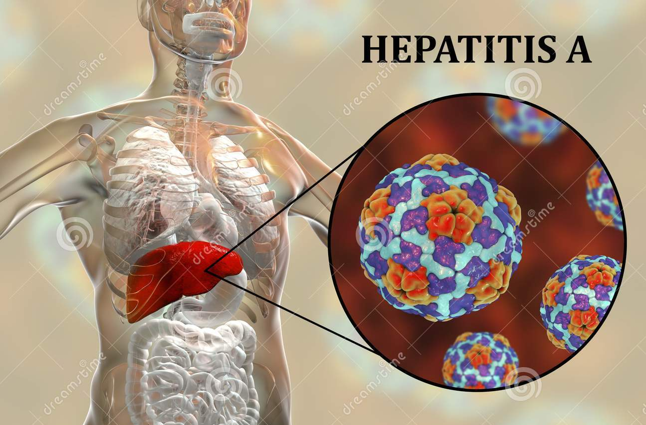 10 respuestas a preguntas sobre la hepatitis A